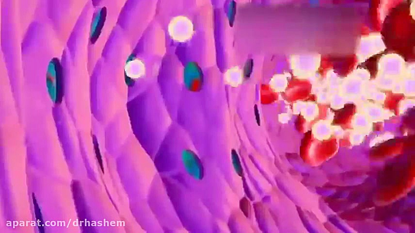 نحو تاثیر داروی شیمی درمانی در افراد مبتلا به سرطان پستان لیزر صورت