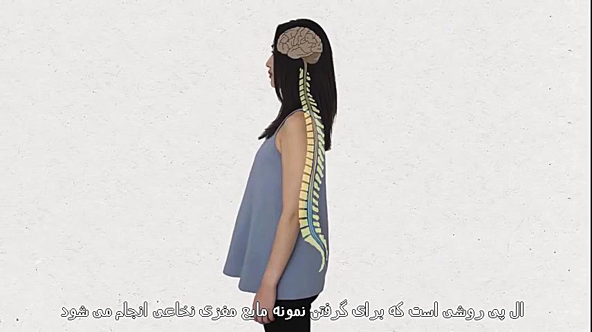 نحوه انجام ال پی یا تخلیه مایع نخاعی آزمون CRISPR-Cas9 اثرات جانبی