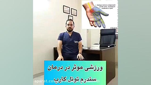 ورزش سندرم تونل کارپ دکتر حسین محمدی