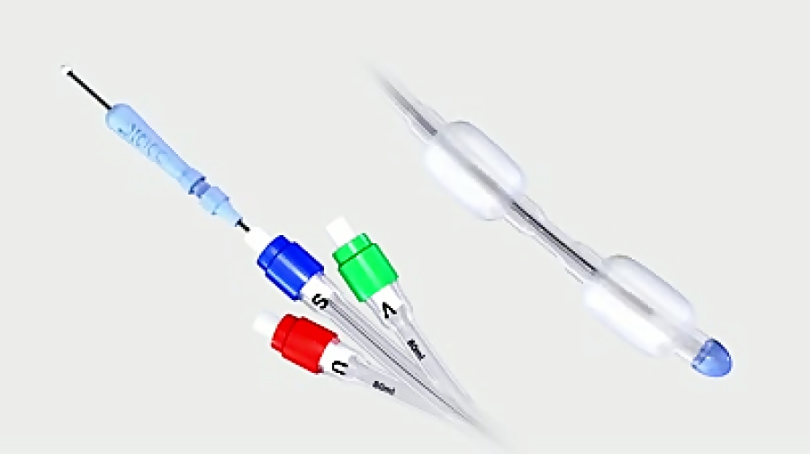 (Cervical Ripening Balloon (CRB