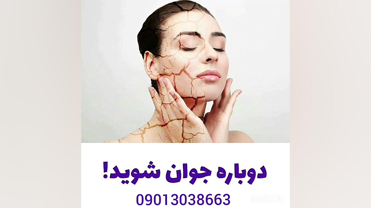 درمان قطعی چین و چروک و لک های صورت برداشتن زگیل