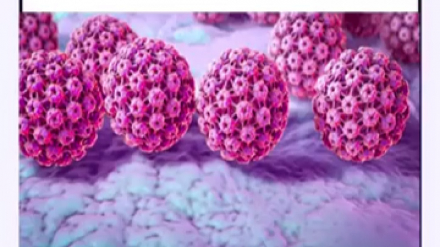 ویروس HPV چیست و چه درمانی دارد؟ (متخصص ویروس شناسی در امریکا) Microarray
