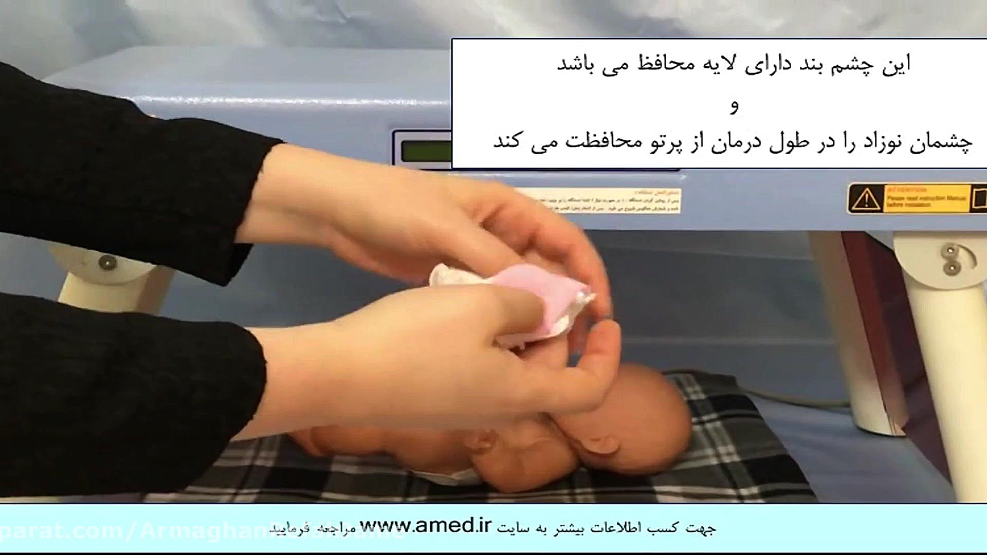 نحوه استفاده از دستگاه فتوتراپی نوزاد خانگی کلینیک پوست