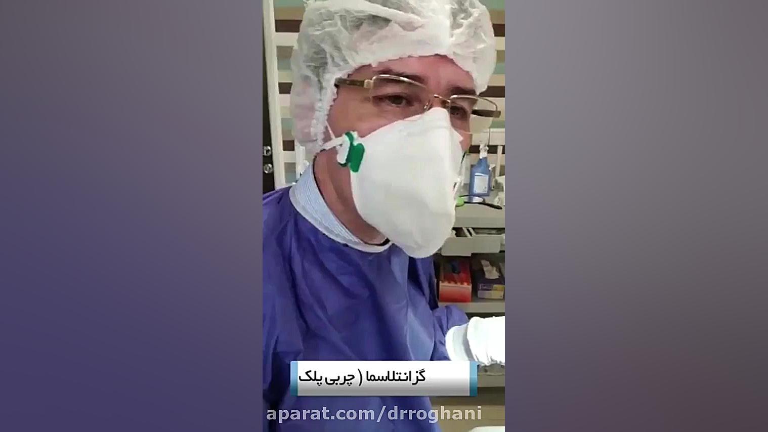 فیلم برداشتن چربی پشت پلک ها دکتر ایمان روغنی جراح و متخصص پوست و مو