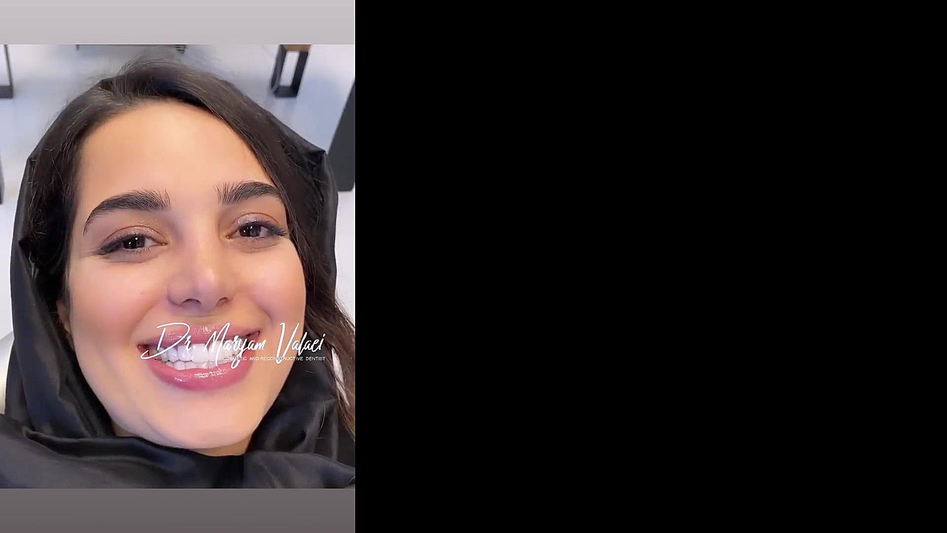 تخصصی ترین مرکز دندانپزشکی زیبایی در منطقه یک ـــ فرشته دندانپزشکی دکتر مریم ولایی