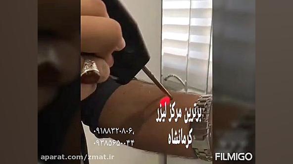 کلینیک تخصصی لیزر آریون ربات میکرونانو جراحی