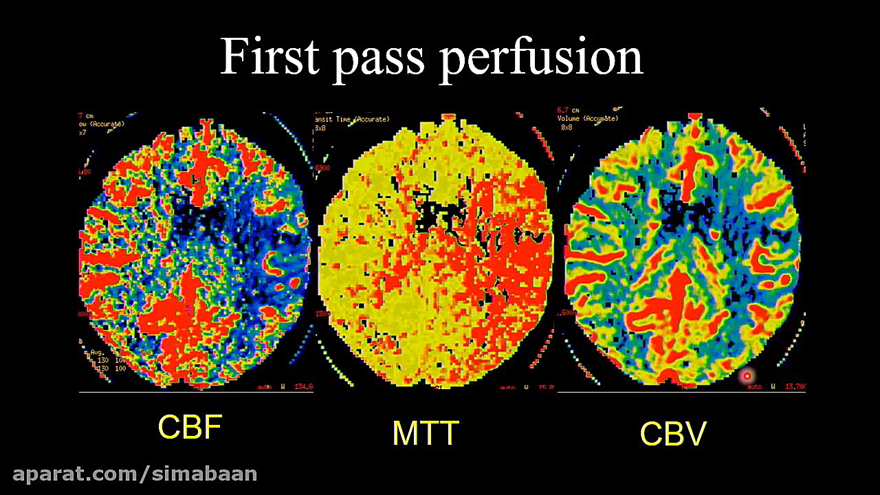 2019 Neuroradiology in Clinical Practice زمان2081ثانیه