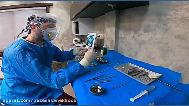 دکتر آرش غفوری متخصص ایمپلنت و جراحی لثه بیماری ترومبوسایتوز اسنشیال
