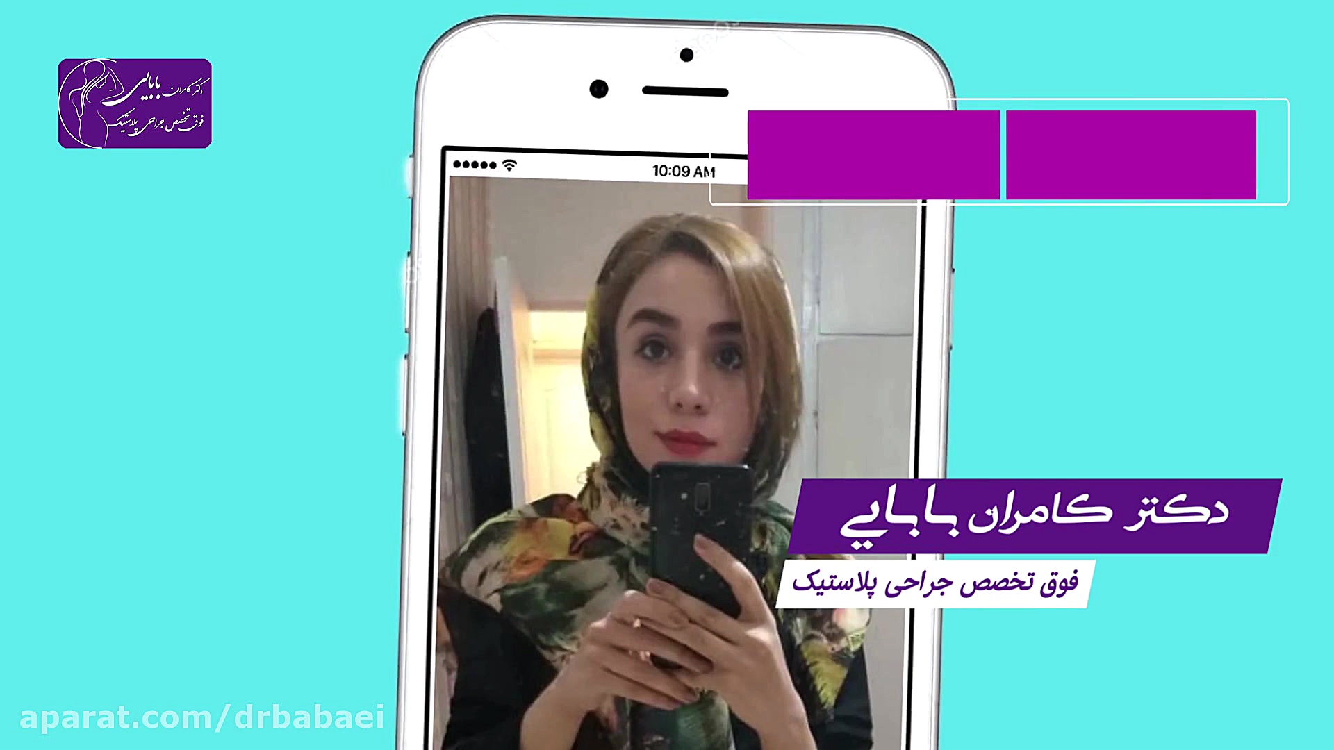 سلفی های بعد از عمل بینی دکتر کامران بابایی