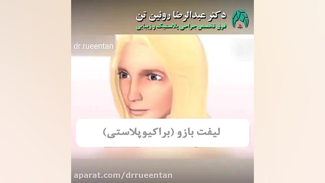 لیفت بازو ( براکیوپلاستی ) | فوق تخصص جراحی پلاستیک | دکتر عبدالرضا روئین تن دکتر عبدالرضا روئین تن