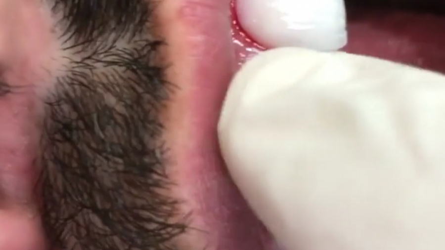 دکتر امیر حسن پور دکتر زیبایی اصفهان لامینیت کریستالی دکتر امیر حسن پور دندانپزشک زیبایی اصفهان