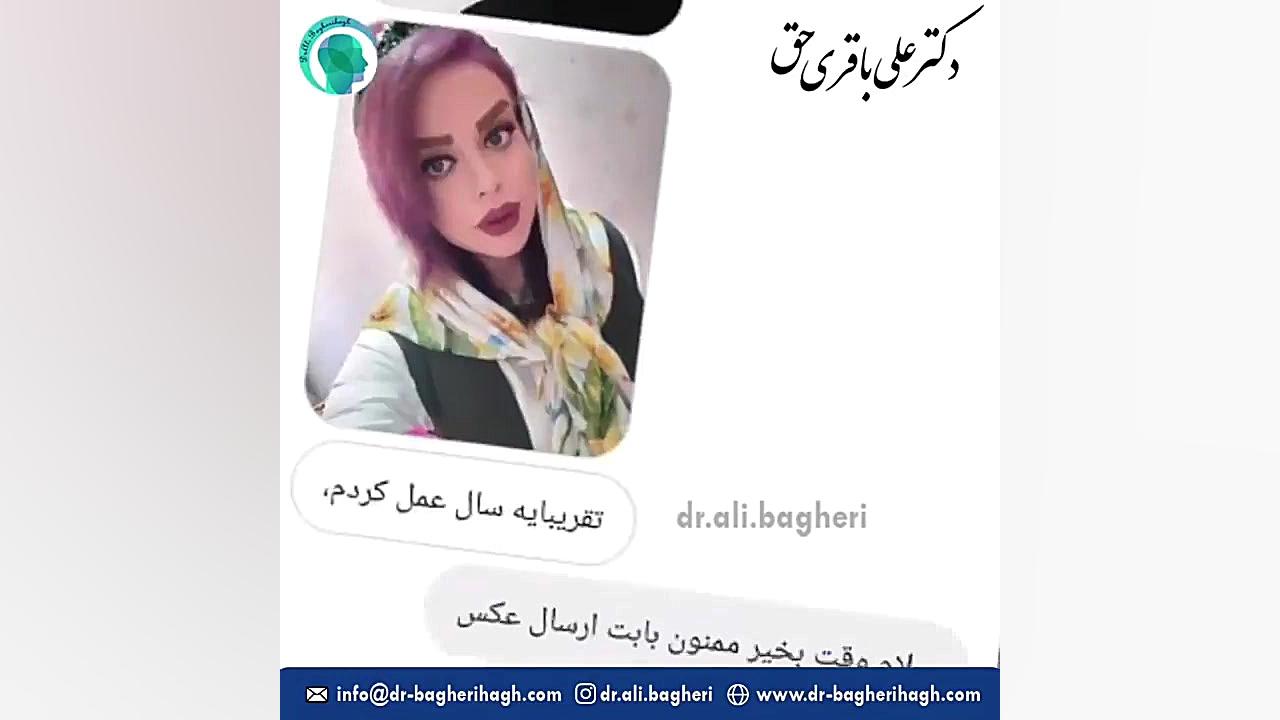 نمونه کار جراحی بینی | جراحی بینی | دکتر باقری حق دکتر علی باقری حق
