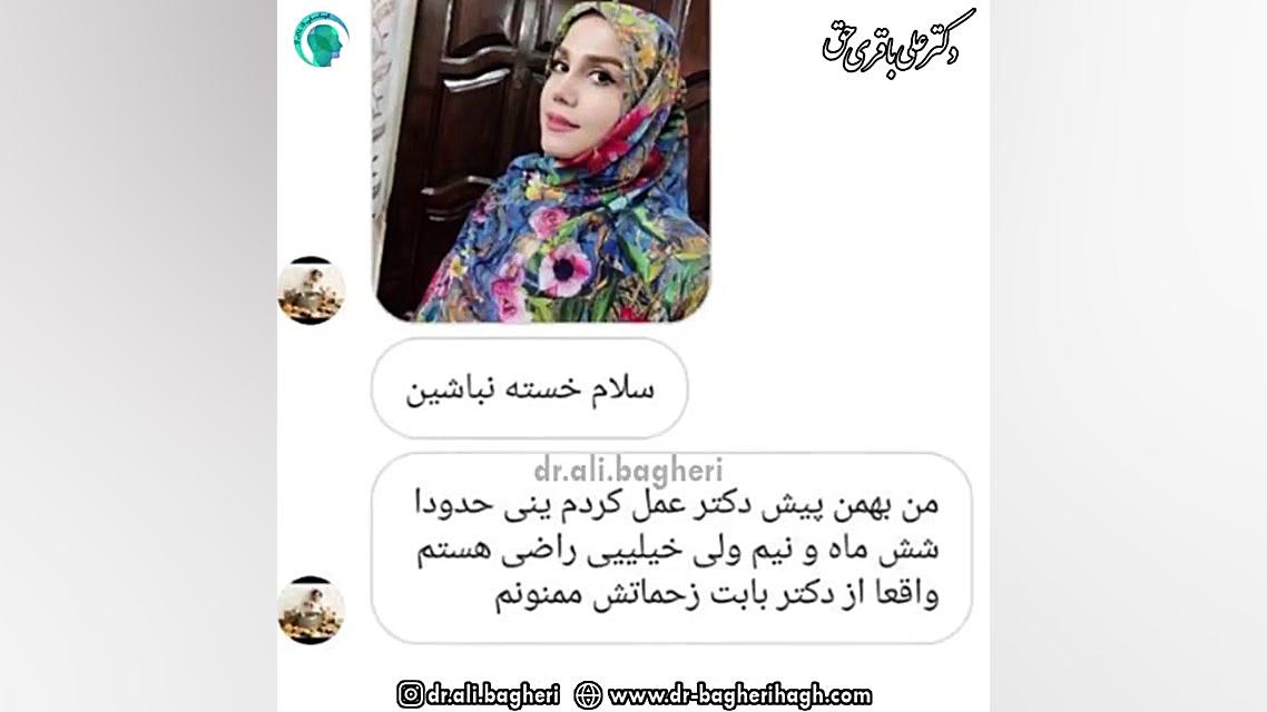 نمونه جراحی بینی | دکتر علی باقری حق جراح بینی دکتر علی باقری حق