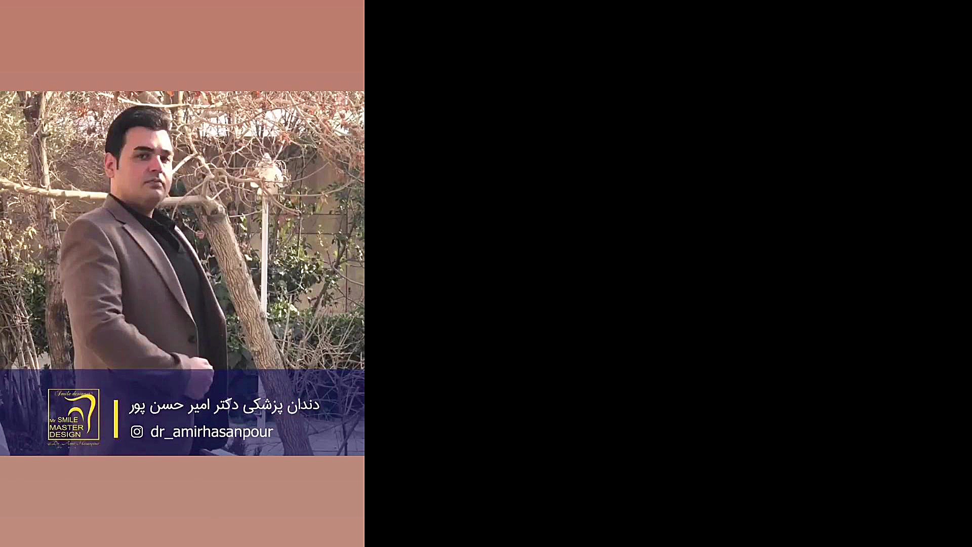 جشنواره خط لبخند با شرایط ویژه دکتر امیر حسن پور اصفهان دکتر امیر حسن پور دندانپزشک زیبایی اصفهان