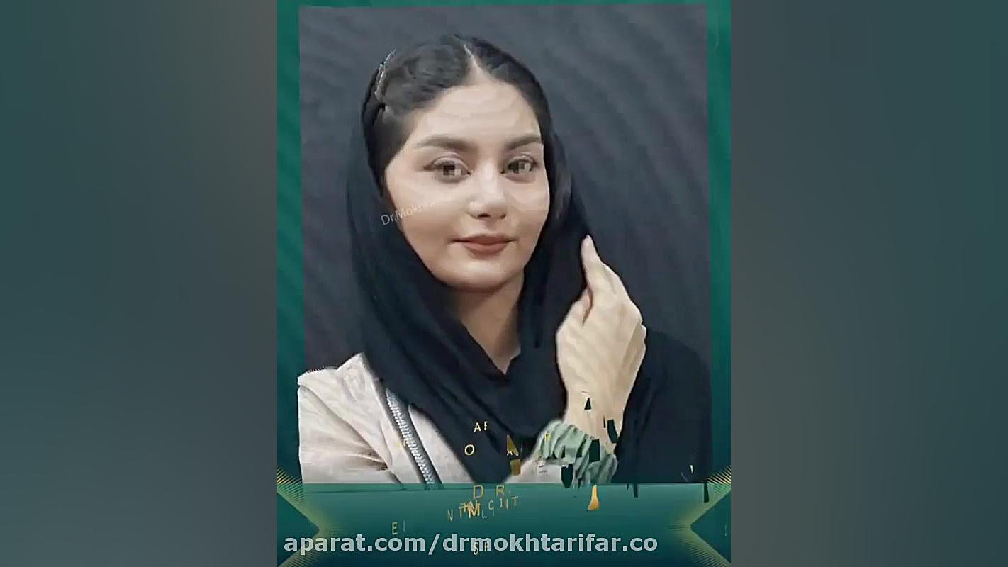 فیلم نتیجه عمل بینی حدود یک ماه پس از جراحی زیبایی بینی دکتر فاطمه مختاری فر جراح بینی در لرستان