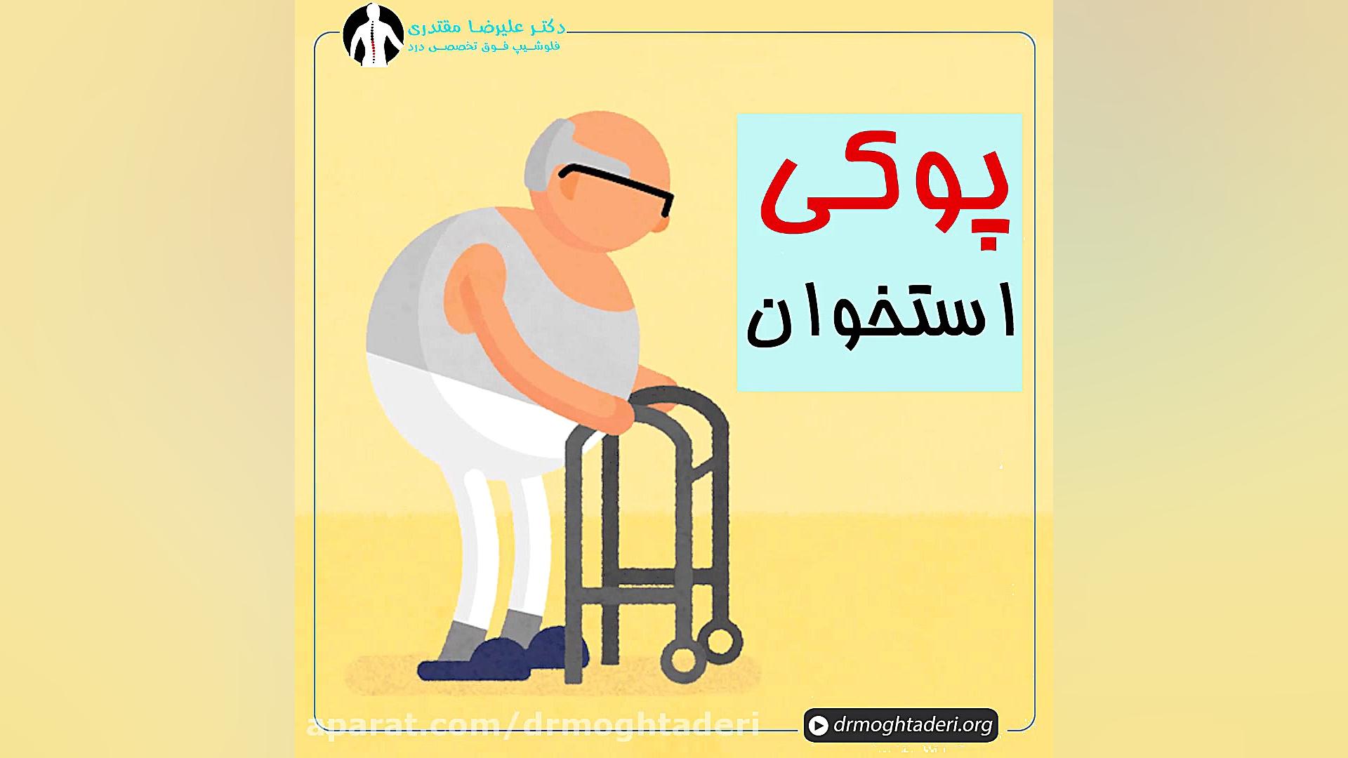 پوکی استخوان روکش دندان