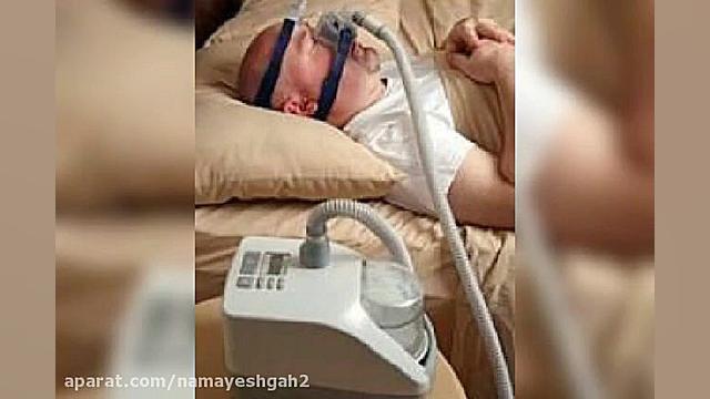 اجاره سی پپ _ بای پپ _ ونتیلاتور _ اکسیژن ساز دندان پیش