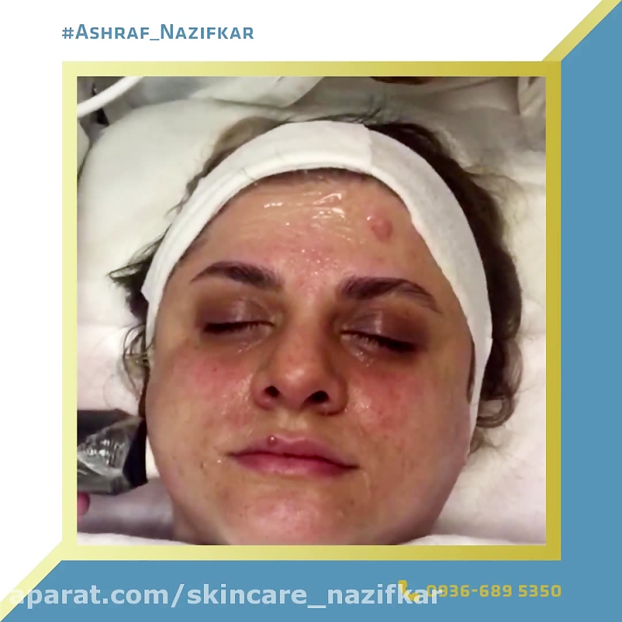 اشرف نظیفکار - مراقبت از پوست و جوانسازی پوست