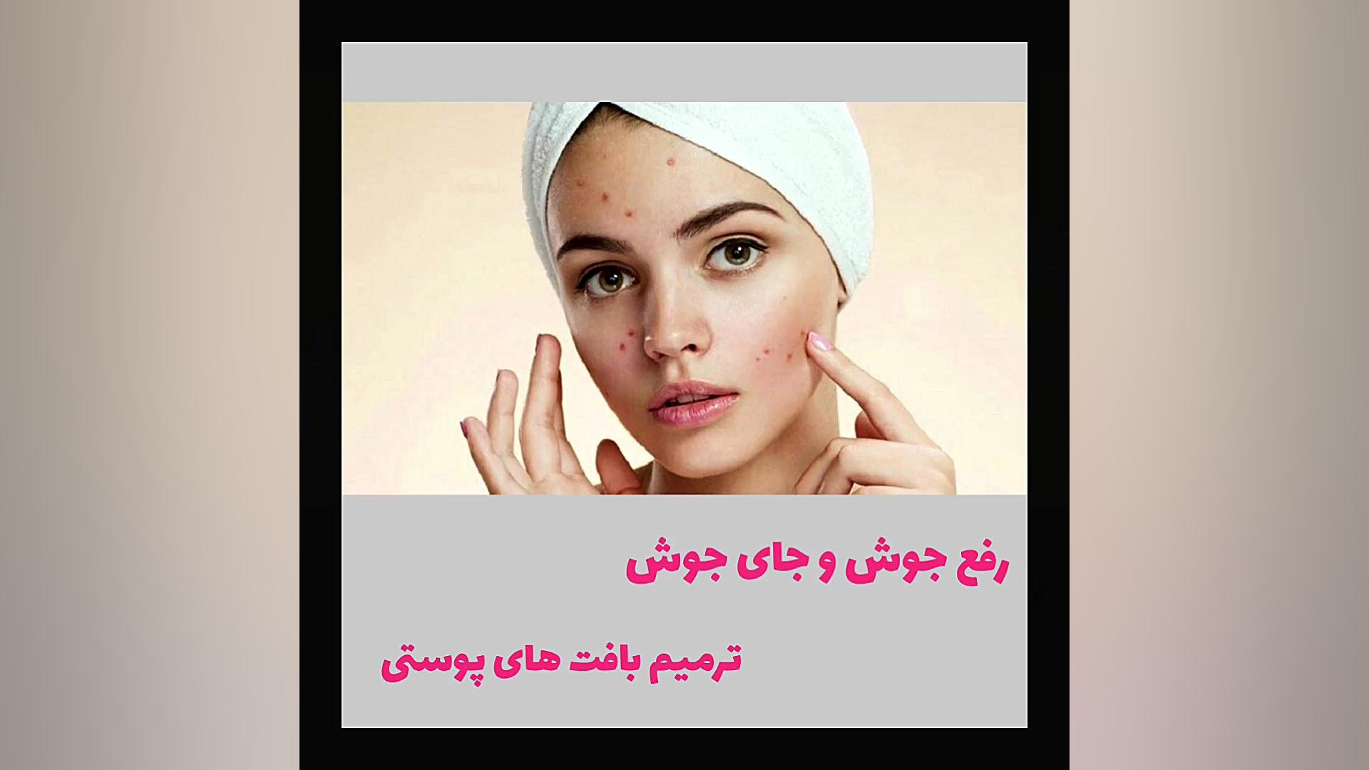 درمان لک و تیرگی پوست با کرم لاکورا (لازان تولید جدید) جراحی لثه