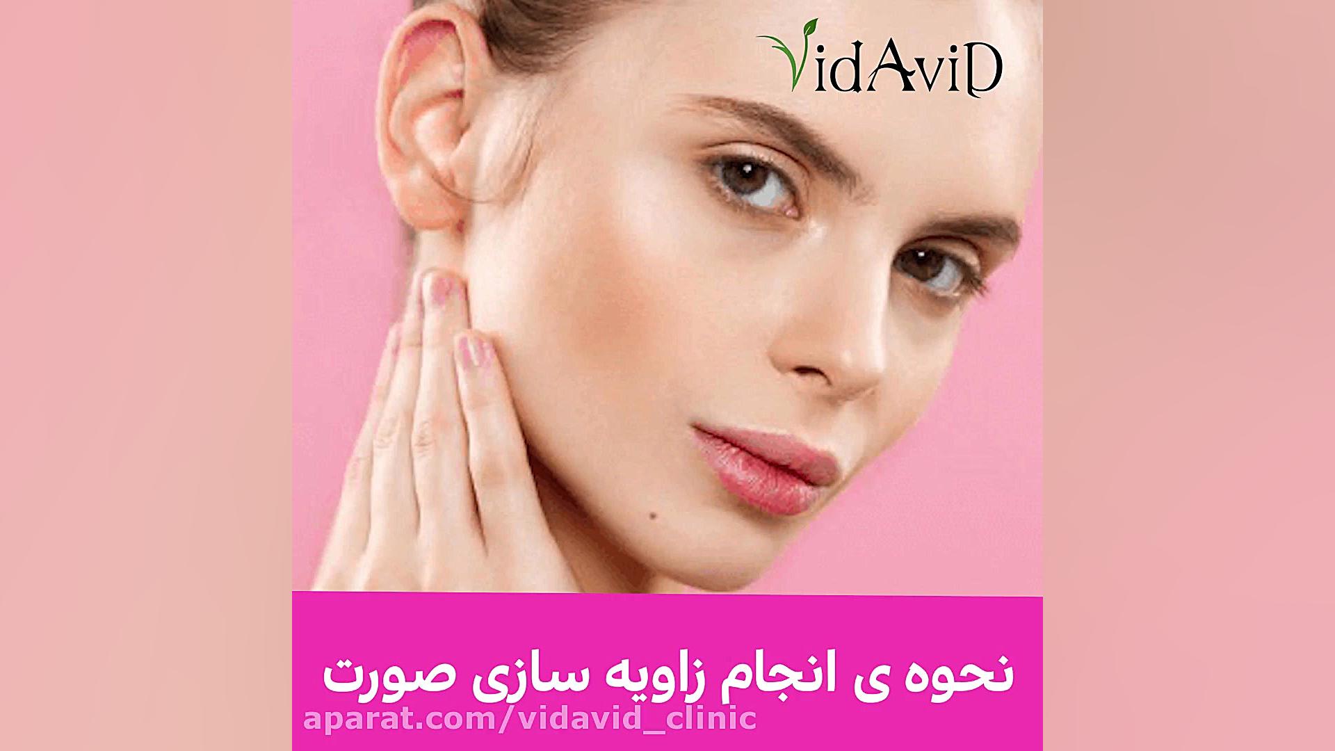 نحوه انجام زاویه سازی صورت CUT&Tag