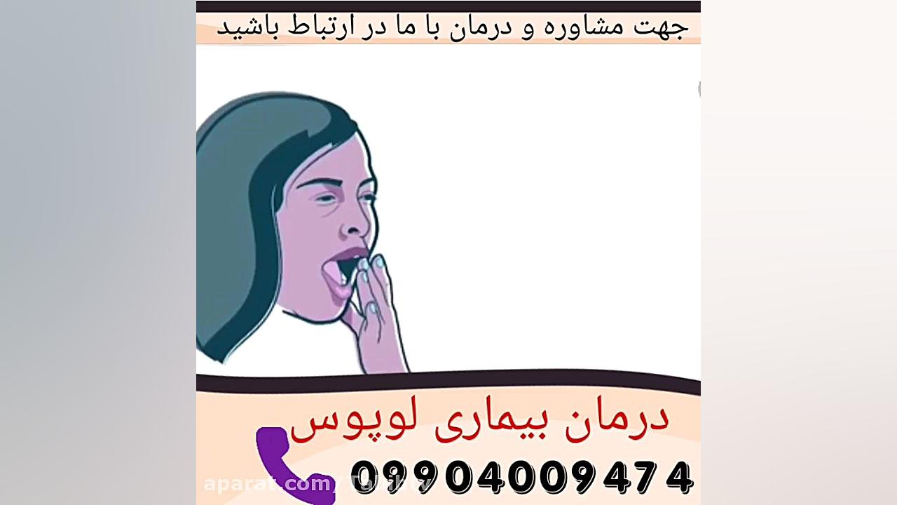 پزشکان برای اولین بار موفق به درمان بیماری لوپوس گردیدند. مزوتراپی