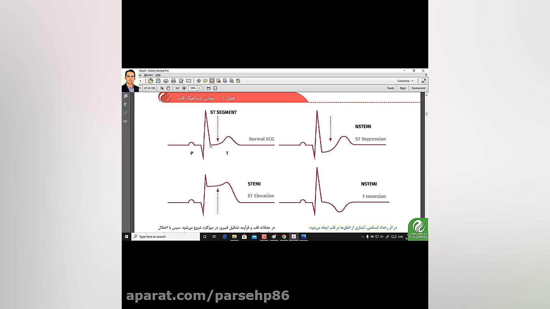 بیماری های قلب ناتالی پورتمن