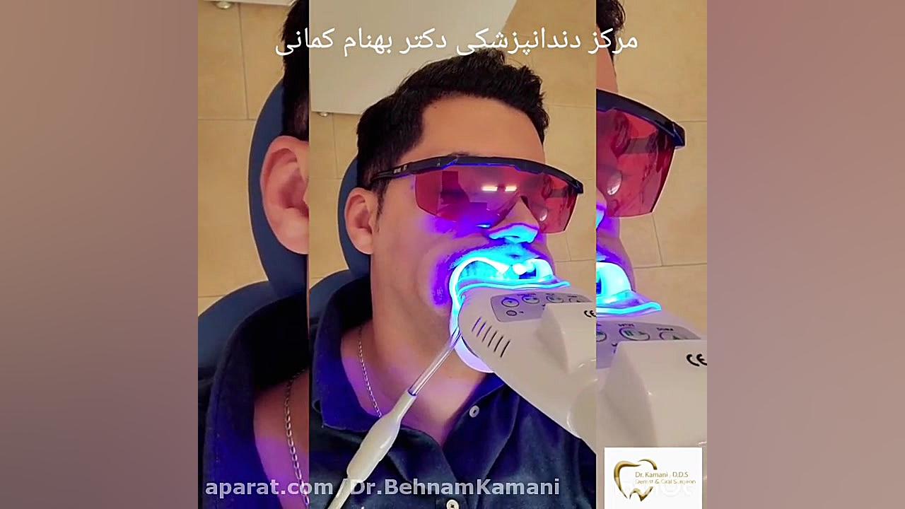 بلیچینگ وزارتان
