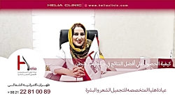 كيفية الحصول على أفضل النتائج...