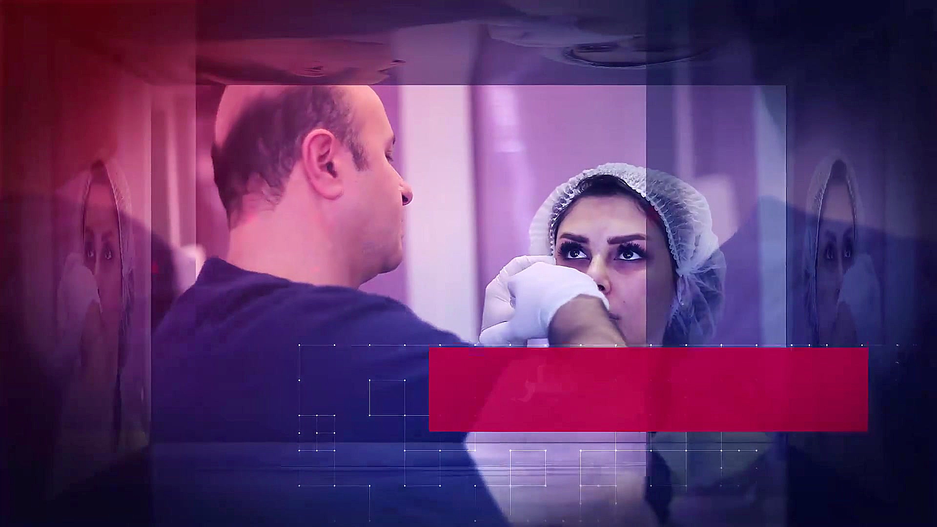 زاویه سازی صورت Super Resolution Microscopy