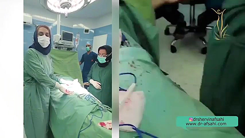 فیلم خارج کردن فیبروم از رحم به همراه توضیحات دکتر شروین افصحی متخصص زنان دندان شیری