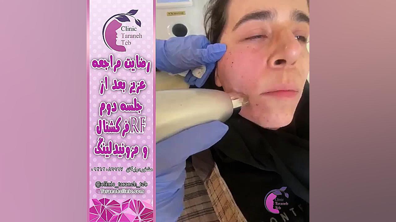 آراف فرکشنال صورت پزشکی زیرآب