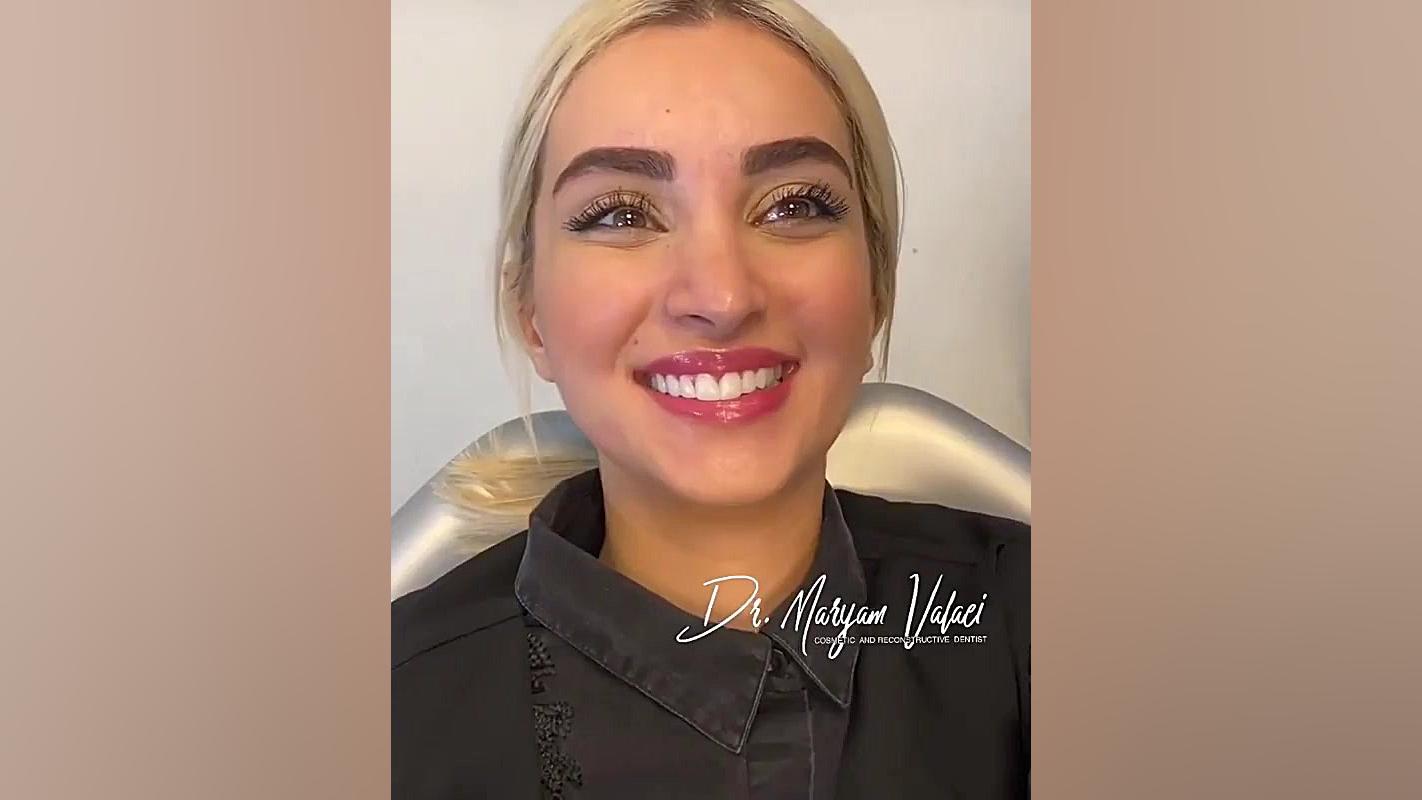 بهترین مرکز دندانپزشکی زیبایی در منطقه یکـ ـــــ الهیه دندانپزشکی دکتر مریم ولایی