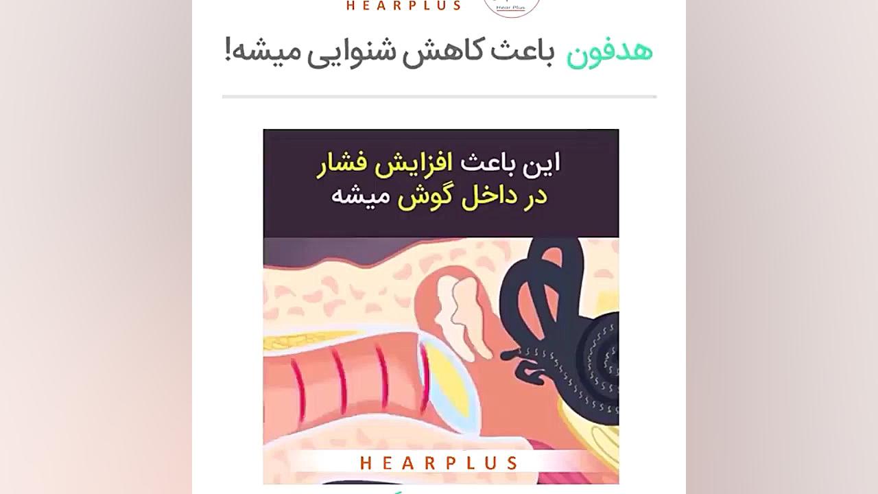 هدفون باعث کاهش شنوایی میشه اندودنتیکس