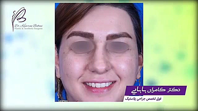 فیلم واقعی عمل بینی دکتر کامران بابایی