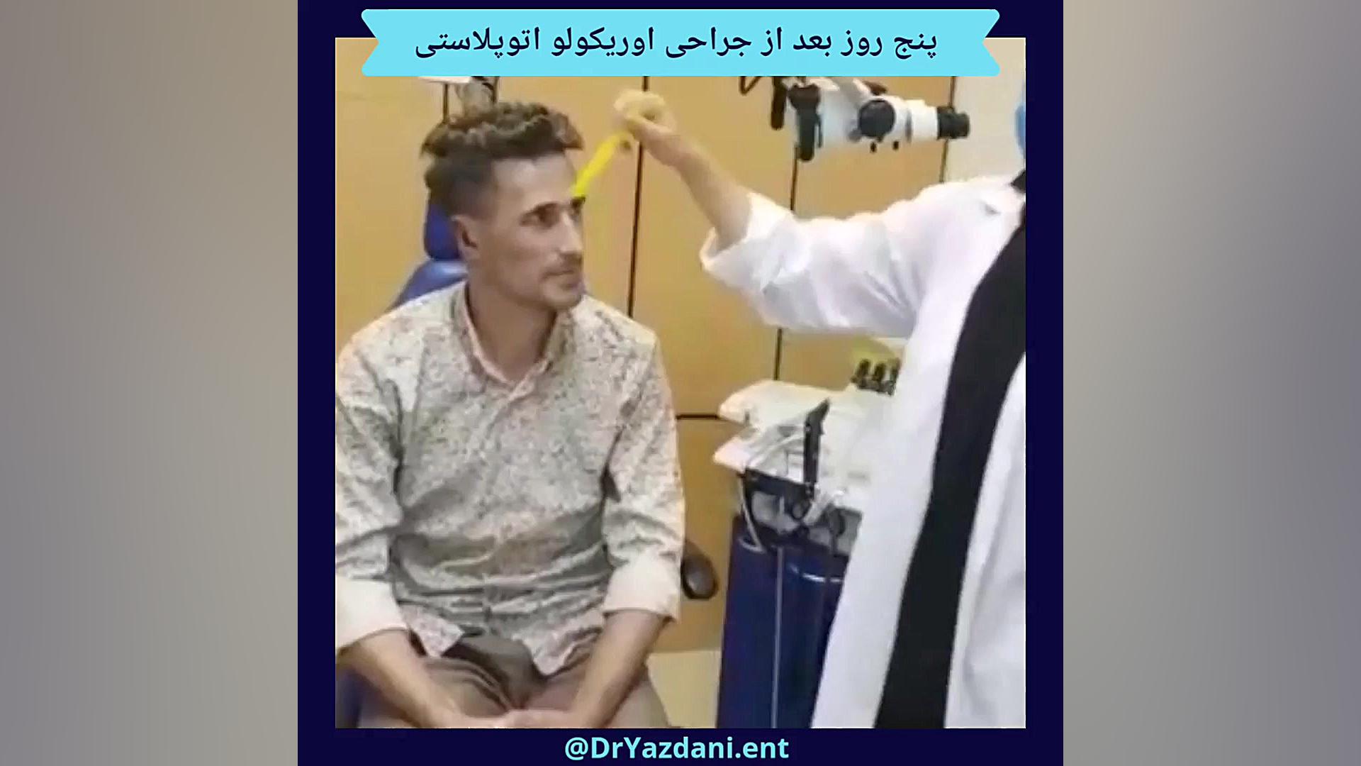 اتوپلاستی دندان شیری