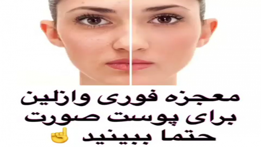 معجزه فوری وازلین برای پوست صورت آر اف فرکشنال