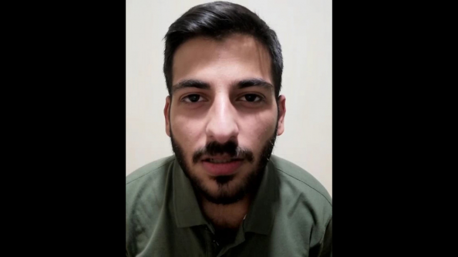 فقر آهن با بیش از ۶۰ درصد مبتلا در بانوان درمان ریزش مو