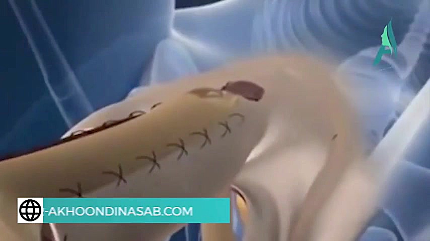 توضیحاتی در خصوص تغییر جنسیت مرد به زن خرگوش اینستاگرامی