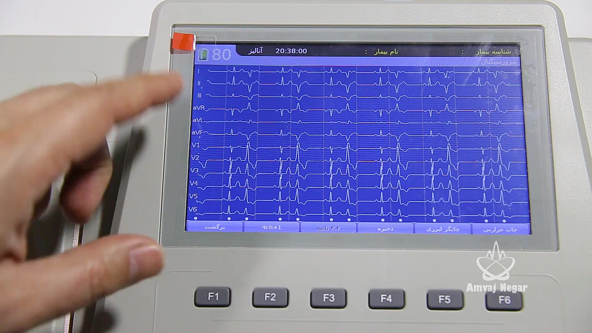 آنالیز یا تحلیل نوار قلب در دستگاه الکتروکاردیوگراف ECG پالپوتومی