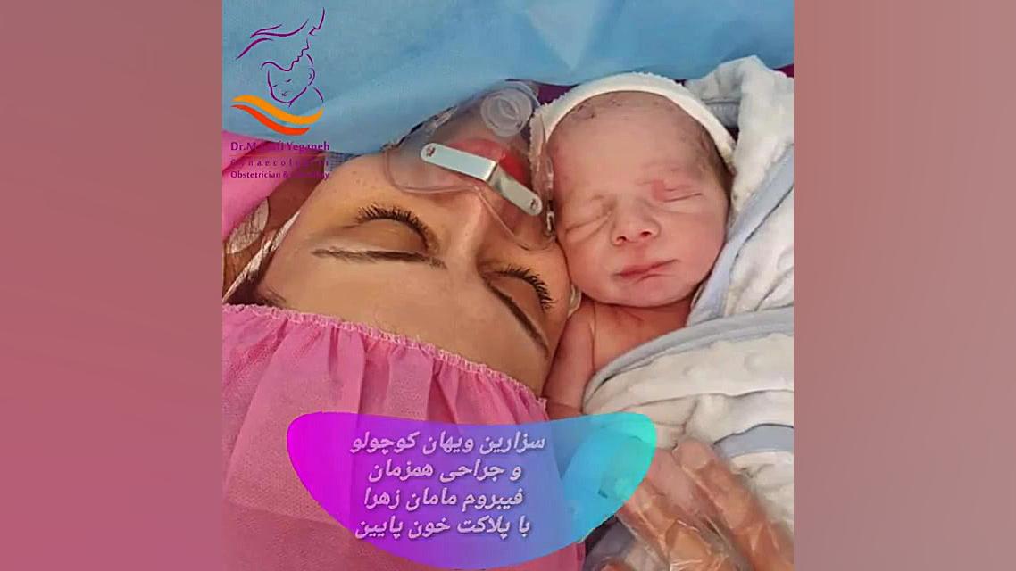 زایمان سزارین همراه با جراحی فیبروم رحم ارتودنسی