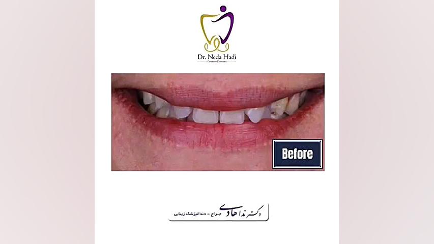 تفاوت را به خوبی لمس کنید دکتر ندا هادی-دندانپزشک زیبایی