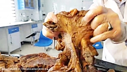 آناتومی سیستم گوارش  دکتر احمد...