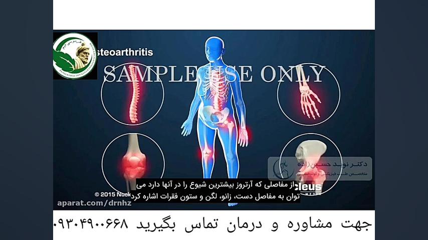 آرتروز چیست؟ درد پا از کجا شروع میشود؟ آیا درمانی هم دارد؟ مایکل جردن