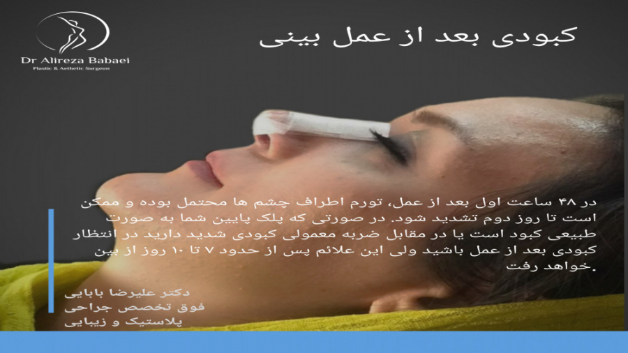 جراحی زیبائی بینی به مفهوم کوچک کردن صرف بینی به هر قیمتی نیست ! دکتر علیرضا بابایی،فوق تخصص جراحی پلاستیک و زیبایی
