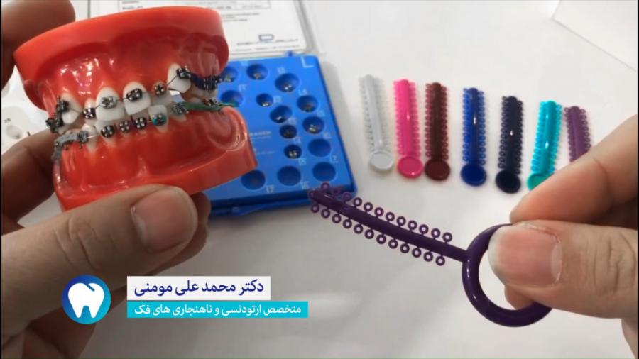 دکتر محمدعلی مومنی | ارتودنسی چیست و چطور انجام می شود؟ دکتر محمدعلی مومنی | متخصص ارتودنسی