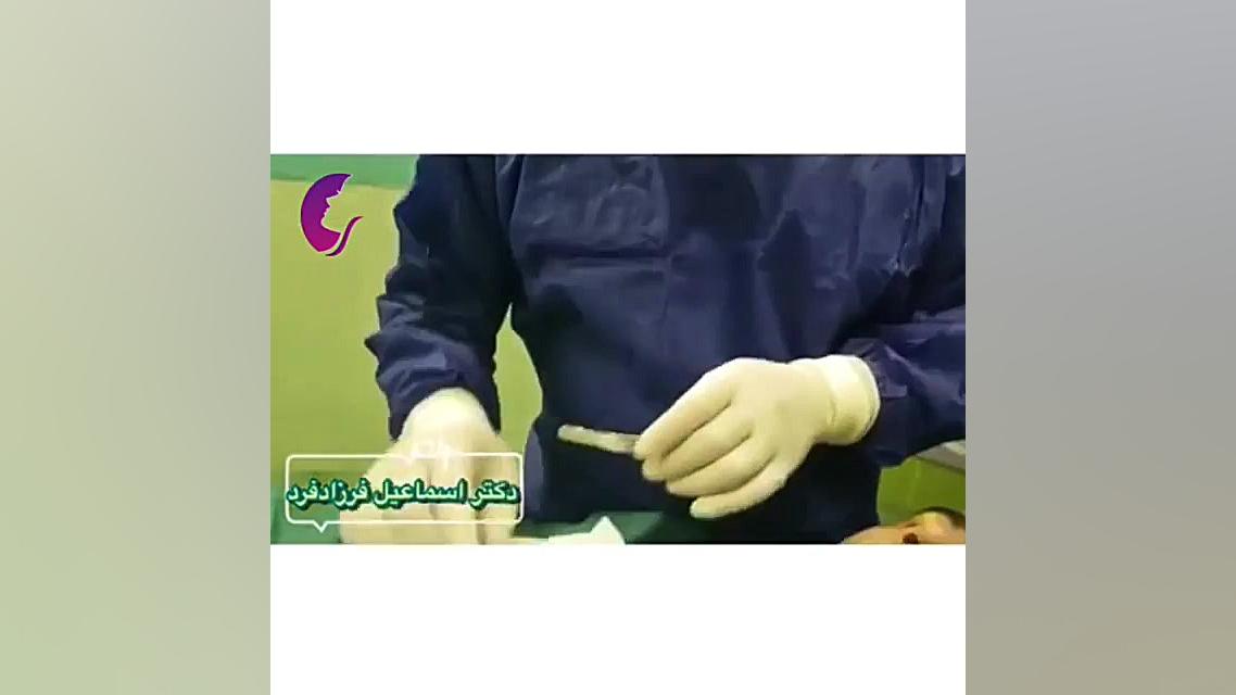 فیلم واقعی گچ بینی دکتر اسماعیل فرزاد فرد - فوق تخصص پلاستیک