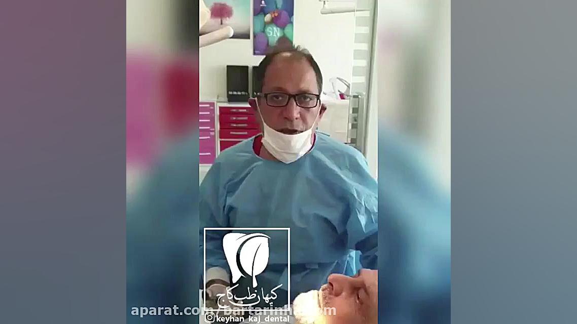 ایمپلنت بدون خونریزی - دکتر کیهان قدیمی دستگاه آنالیز اگزوزوم