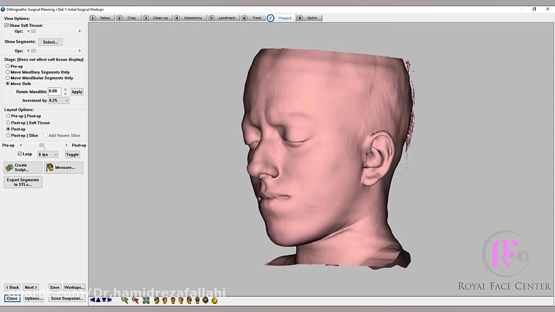 طراحی و پیش بینی نتایج جراحی بیمار ارتوسرجری دکتر حمیدرضا فلاحی