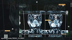 فیلم عمل توده گردنی
