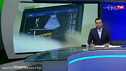 ساخت نخستین دستگاه سونوگرافی بومی لیزر صورت